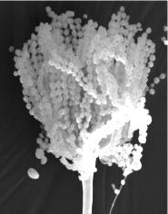 Aspergillus im REM bei 2500 facher Vergrerung