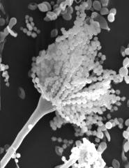 Aspergillus im REM bei 3000 facher Vergrerung