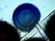 Aspergillus Niger im Lichtmikroskop bei 400 facher Vergrerung