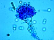 Aspergillus parasiticus Schimmelpilz im Lichtmikroskop bei 600-facher Vergrerung