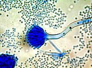 Aspergillus terreus Schimmelpilz im Lichtmikroskop bei 600-facher Vergrößerung
