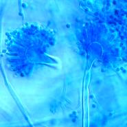 Aspergillus versicolor Schimmelpilz im Lichtmikroskop bei 400-facher Vergrößerung