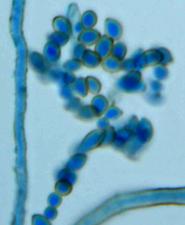Cladosporium Schimmelpilz im Lichtmikroskop bei 400-facher Vergrerung