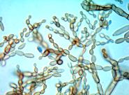 Cladosporium sphaerospermum im Lichtmikroskop bei bei 600 facher Vergrerung