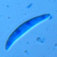 Fusarium culmorum Sporen im Lichtmikroskop bei 400-facher Vergrerung
