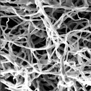 sterilies Pilzgeflecht (Mycelia sterilia) im REM bei 1800-facher Vergrerung