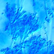 Penicillium chrysogenum Schimmelpilz im Lichtmikroskop bei 400-facher Vergrerung
