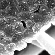 Rhizopus stolonifer Sporen im REM bei 7000-facher Vergrerung