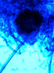 Rhizopus stolonifer Schimmelpilz im Lichtmikroskop bei 400-facher Vergrerung