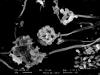 Stachybotrys in verschiedenen Wachstumsphasen im Rasterelektronenmikroskop bei 2920-facher Vergrerung